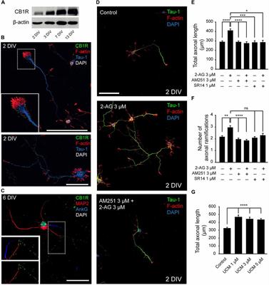 Cannabinoid Receptors Modulate Neuronal Morphology and AnkyrinG Density at the Axon Initial Segment